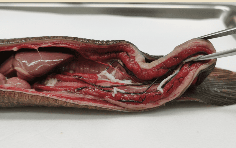 Ruột lươn bị trương